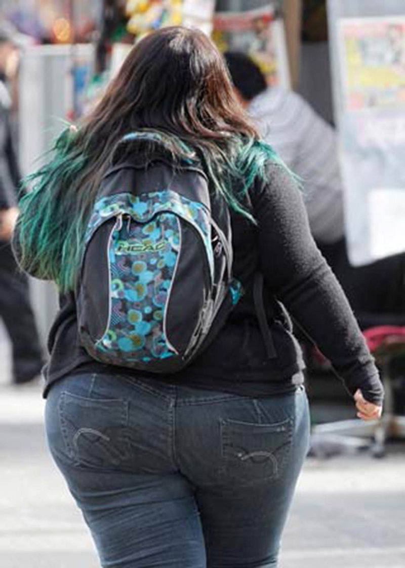 Mujeres obesas presentan más fracturas por fragilidad