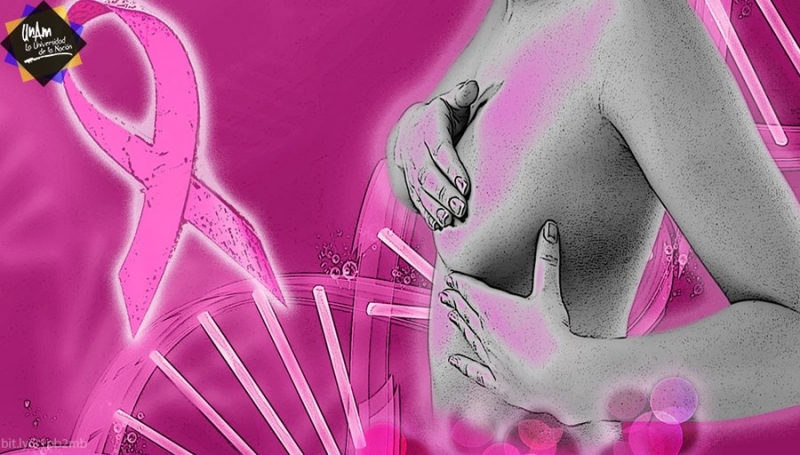 En México, entre 10 y 12 mujeres mueren al día por cáncer de mama