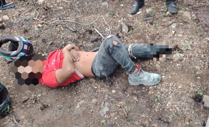 Motociclista pierde  el pie en accidente