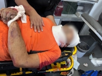 Ciclista lesionado en siniestro vial