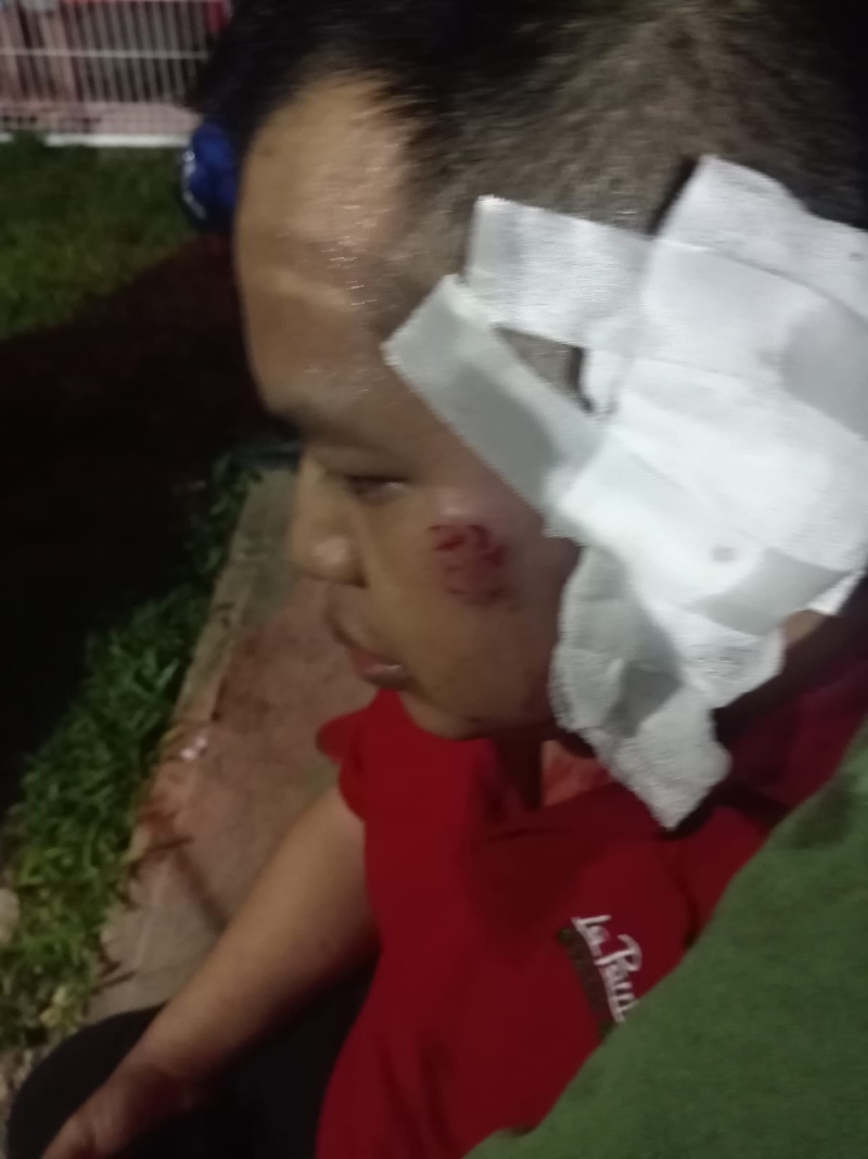 Perro arranca oreja a su dueño