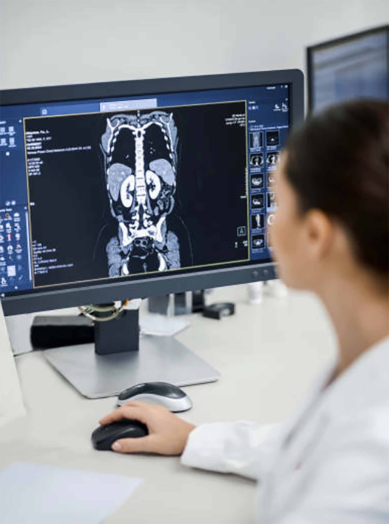 Enfermedad renal suele ser silenciosa: investigadora