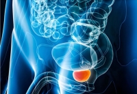 La vergüenza mata, cáncer de próstata